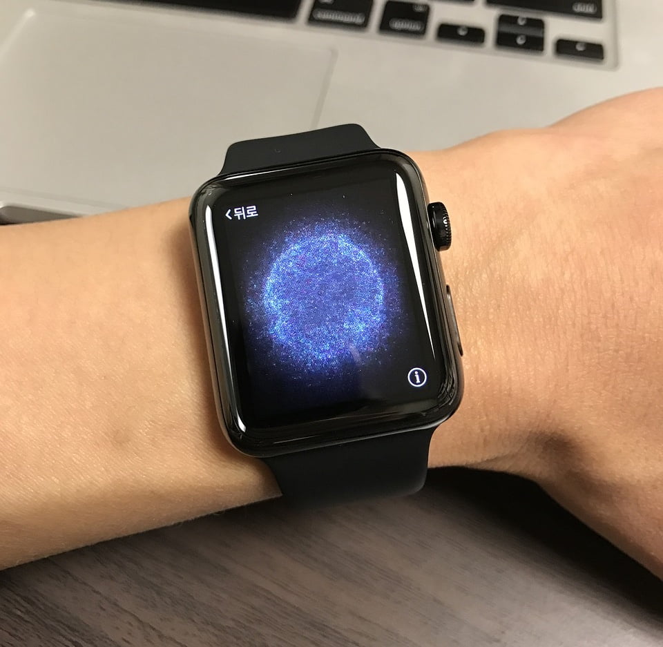 Apple Watch Fitbit Xiaomi 1