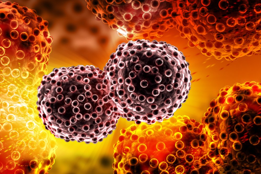 Cancer Traitement Innovation Sante Technologie