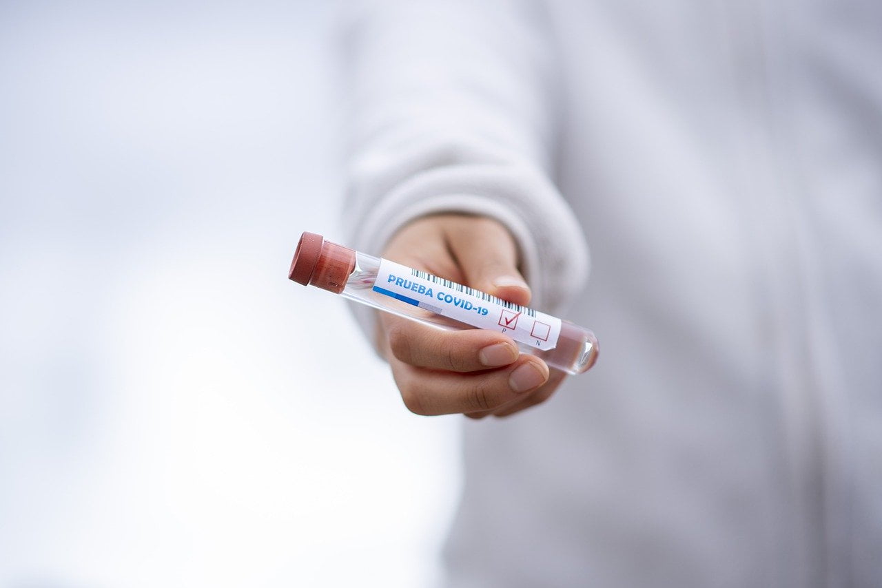 Test Tube 5065426 1280