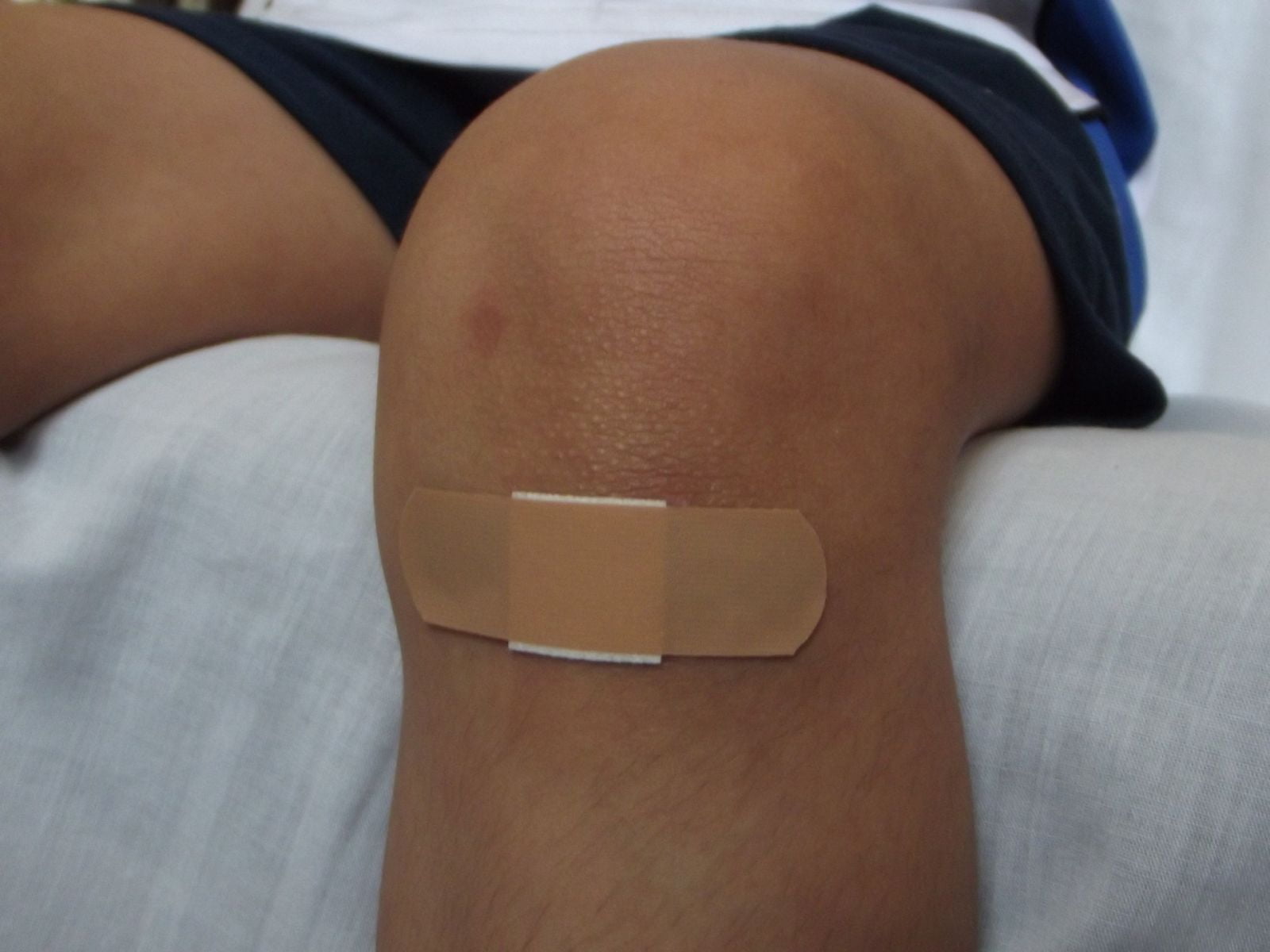 Wound 106374 1920