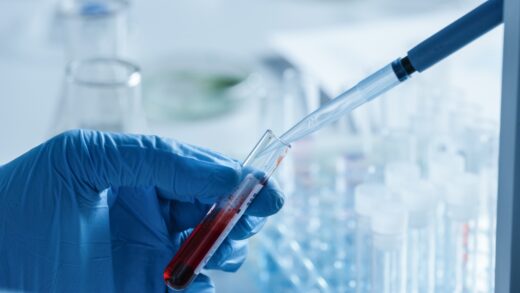ce-test-sanguin-detecter-alzheimer-etats-unis